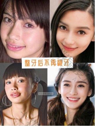 正畸有年龄限制吗