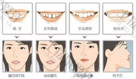 牙齿咬合错位必须正畸吗