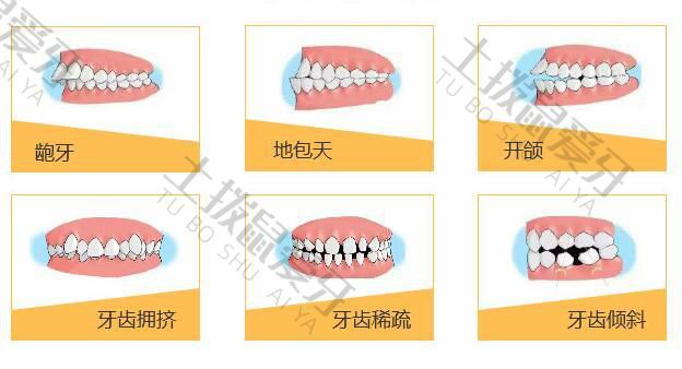 正畸的适应症