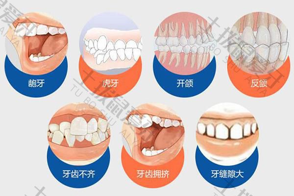 正畸矫正费用