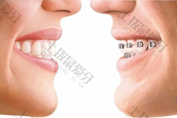 成年牙齿矫正价格表