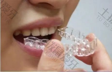 牙齿矫正半口和全口价格