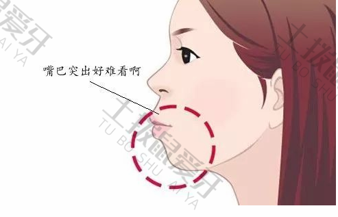 儿童牙齿早期矫正批发价格