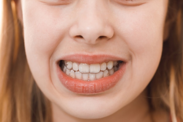 牙齿矫正的常用方法