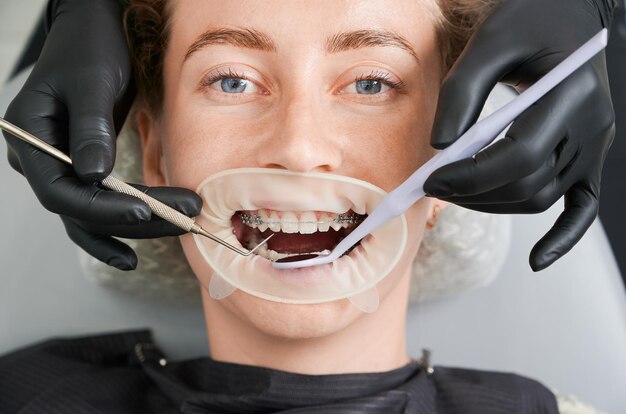 需要正颌+矫正的牙齿类型