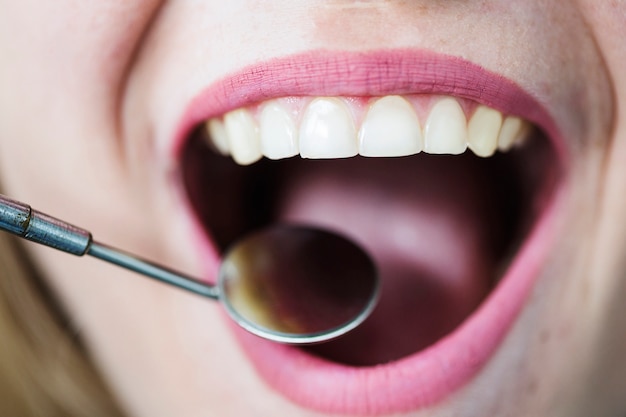 牙齿矫正期间张嘴睡觉是否有影响