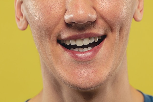 智齿挤歪的牙齿需要干预矫正吗