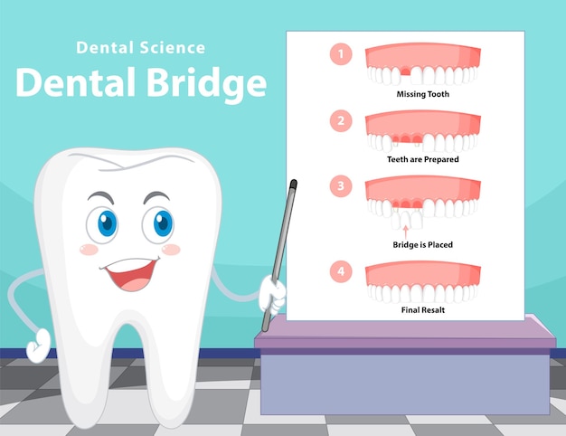 种植牙的流程和选择标准