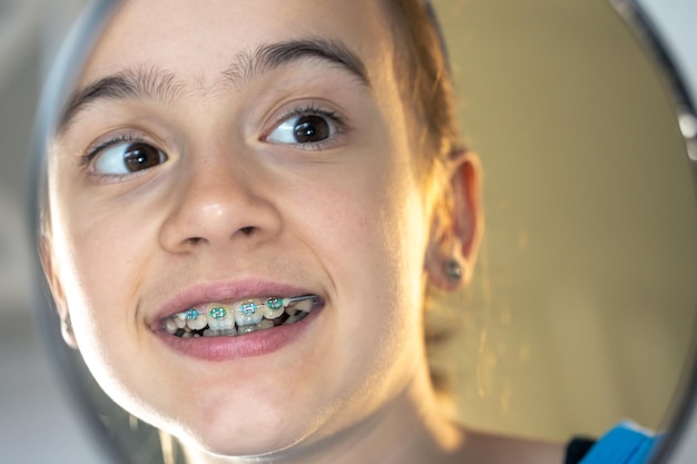 儿童牙齿矫正牙套的戴法