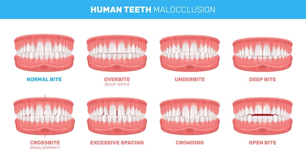 牙齿治疗的类型