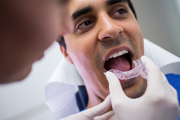 成人牙齿矫正的常见方法