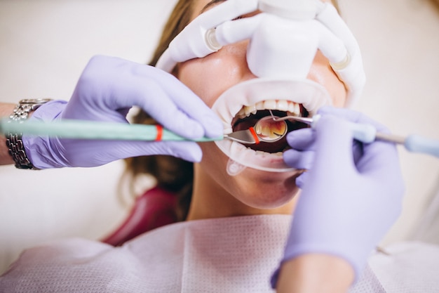 钢丝牙套牙齿矫正的过程及特点
