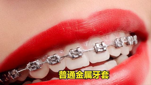 快速矫正牙齿副作用