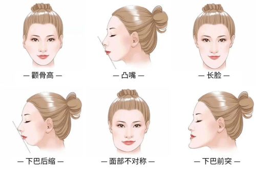牙颌畸形的类型与成因