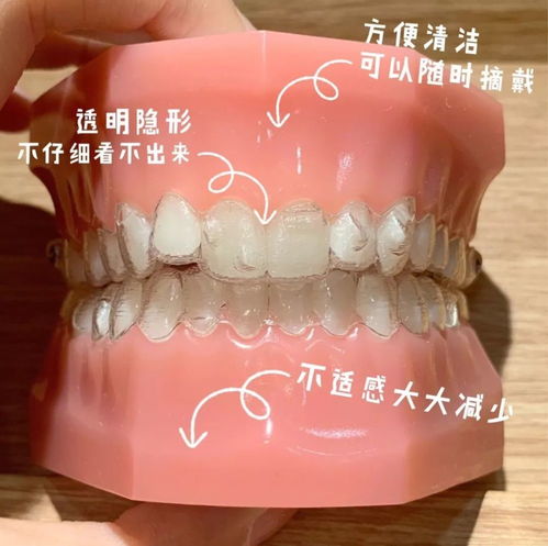 牙齿矫正后嘴凸反弹的原因