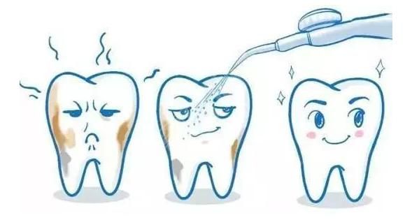 做完植牙后还需要做哪些护理