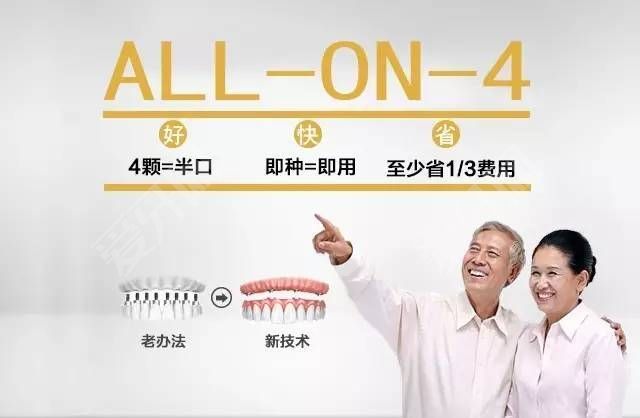 all-on-4植牙能用多久