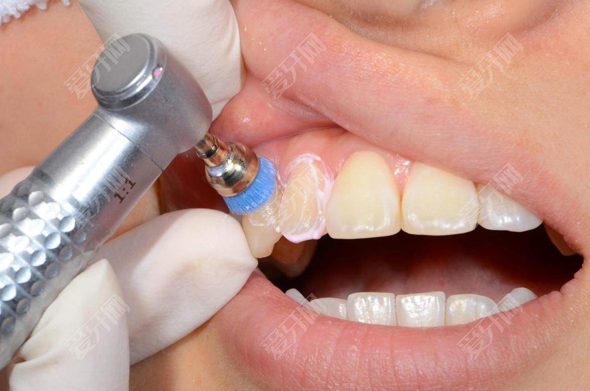 种植牙寿命受植牙体影响吗