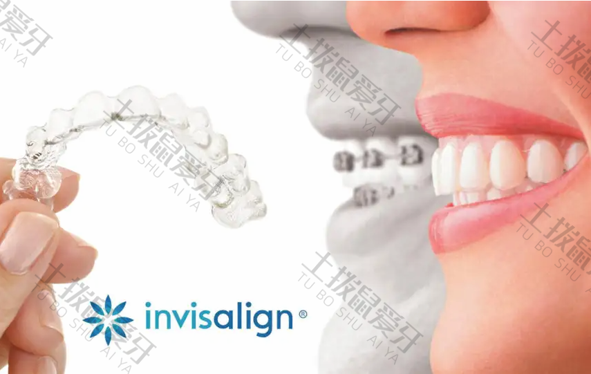 进口隐适美Invisalign