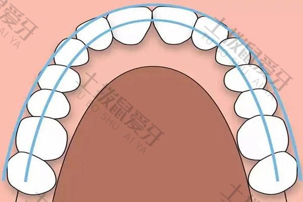 地包天牙齿矫正器怎么戴