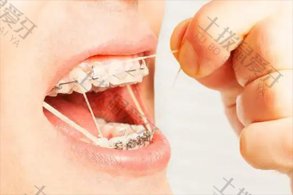 最快的牙齿矫正方法