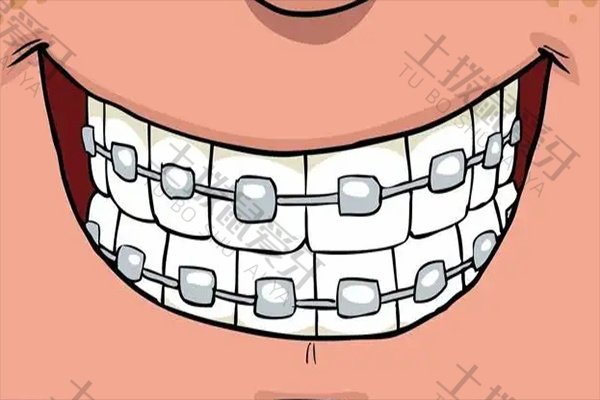 牙齿怎么矫正 牙齿歪了怎么矫正