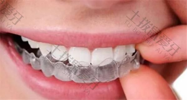 成人牙齿矫正时间多长 成人牙齿矫正时间多久