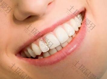牙齿不齐的矫正方法有哪些 牙齿不齐怎么矫正