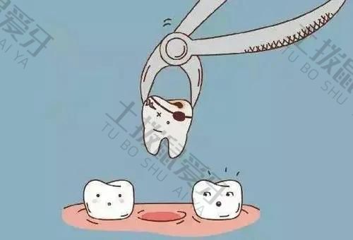 门牙拔牙后多久可以种植牙