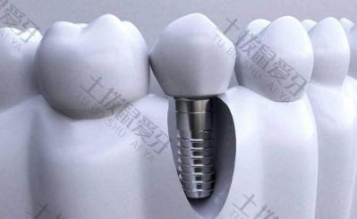 种植牙拆线疼吗 种植牙手术后注意事项有哪些
