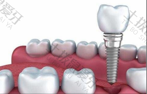 种植牙后牙龈萎缩可以恢复吗