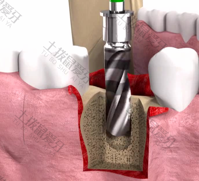 https://www.tuboshu.cn//public/upload/hospital/2022/11-28/454d47b4fb656c061f3f9558ef6ed370.jpg