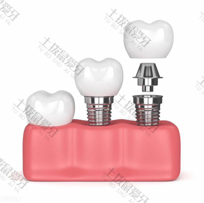 门牙植牙过程是怎样的