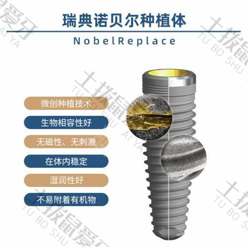 进口种植牙哪个品牌好