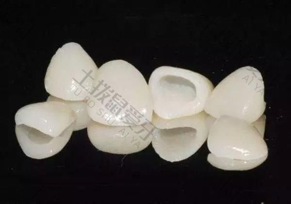 种植牙的牙冠种类有哪些