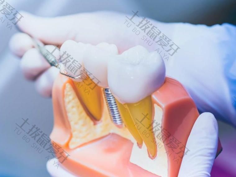 种植牙手术过程复杂吗