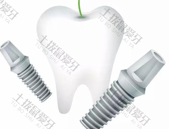 种植牙二期手术后多久可以装牙