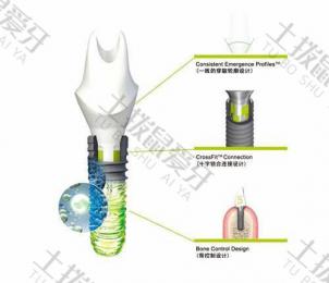 瑞士iti种植牙价格是多少 瑞士iti种植牙怎么样