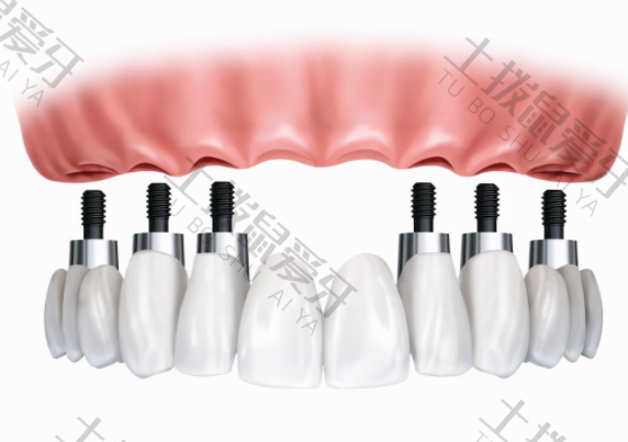 种植牙二期手术过程后注意事项