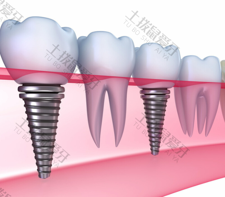 种植牙手术后疼痛难忍
