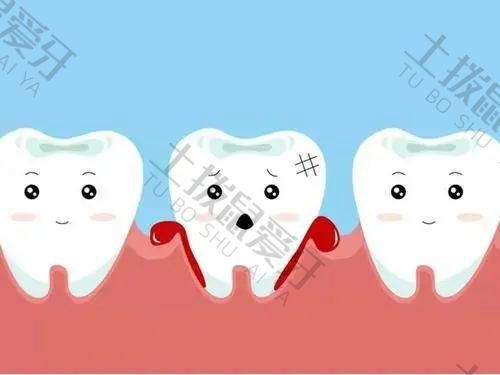种植牙最难受的环节是哪一个步