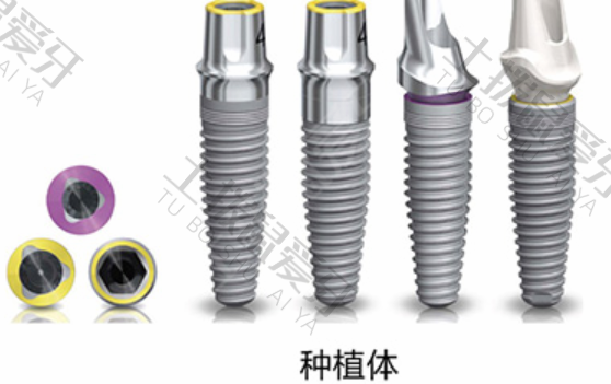 瑞士种植牙品牌有几种类型