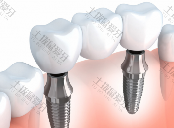 门牙可以做种植牙吗 种植牙基台价格