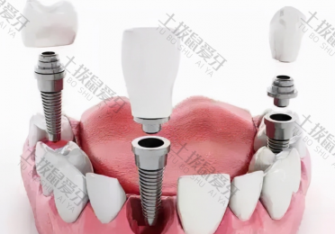 种植牙植骨粉会肿多久 种植牙植骨粉后多久可以种牙