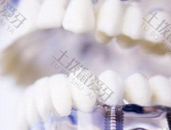 种植牙手术费用 种植牙手术需要多长时间