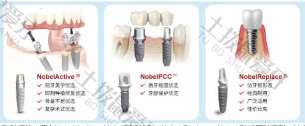瑞士诺贝尔种植牙好不好