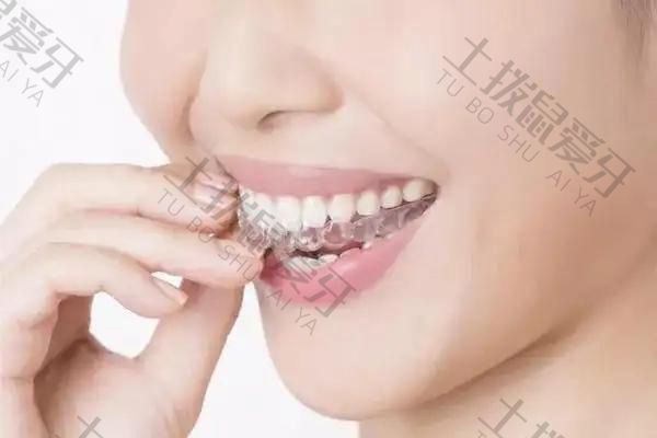 牙齿矫正后出现黑三角有什么影响吗