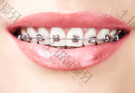 牙龈龅牙有办法矫正吗