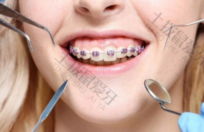 有智齿可以矫正牙齿吗 矫正牙齿前需要做什么检查
