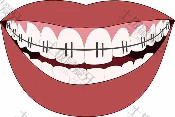 矫正牙齿会牙龈萎缩后期会恢复吗